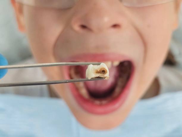 Best Emergency Pediatric Dentist  in Century, FL